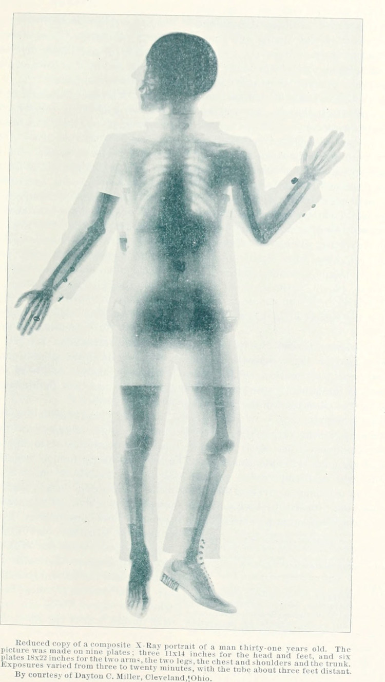 images_my_ideas_15/15_WC_American_X-ray_journal_1897.jpg
