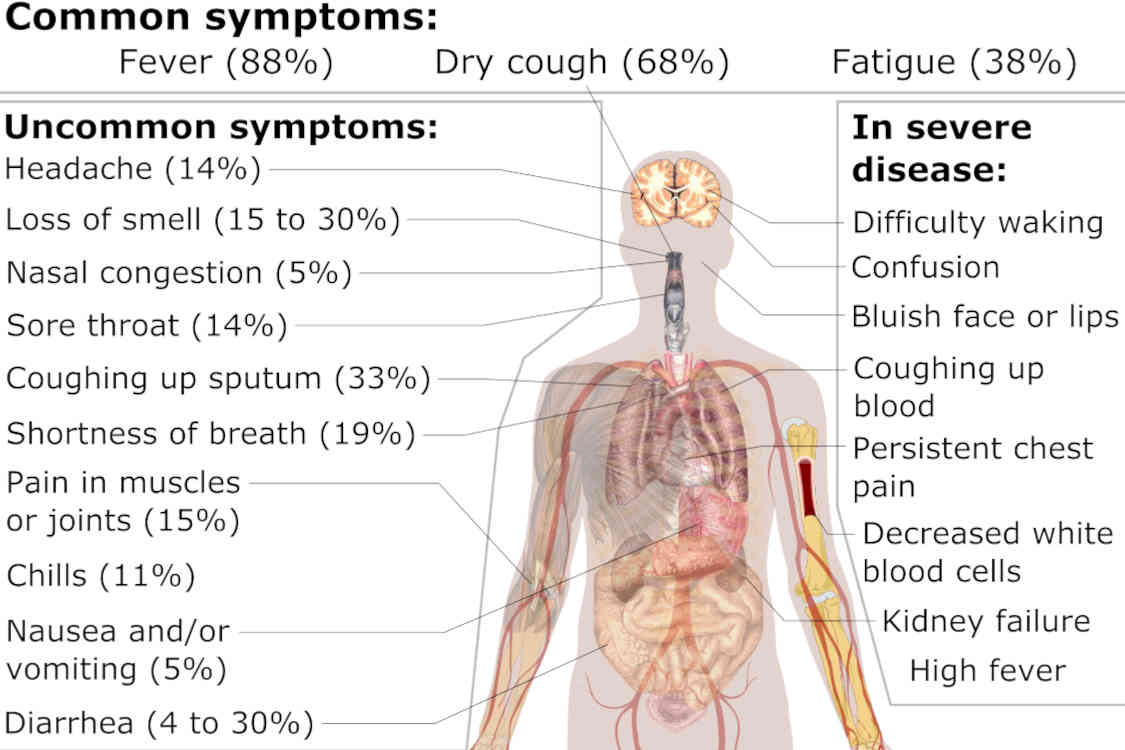 images_my_ideas_24/24_WC_Mikael_Haggstrom_Symptoms_Of_Coronavirus_Disease.jpg
